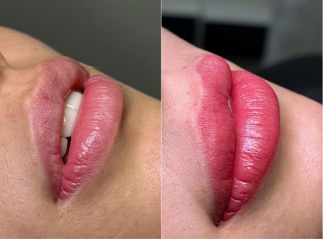 Micropigmentación de labios