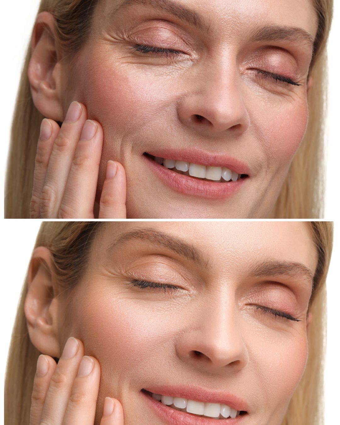 Estética facial